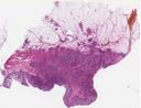 sample A (block 2, slide 87)