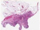 sample A (block 2, slide 180)