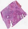 sample B (block 1, slide 1)