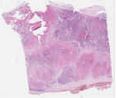sample B (block 1, slide 49)