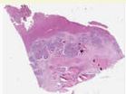 sample B (block 2, slide 50)