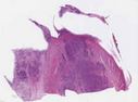 sample A (block 1, slide 1)