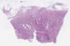 sample B (block 1, slide 1)