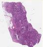 sample D (block 2, slide 71)