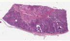 sample A (block 1, slide 165)