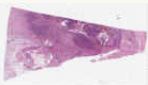 sample D (block 1, slide 1)
