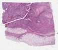 sample E (block 1, slide 165)