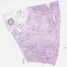 sample A (block 1, slide 1)