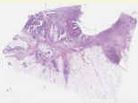 sample C (block 1, slide 1)