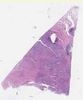 sample D (block 2, slide 101)