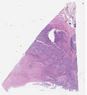 sample D (block 2, slide 157)
