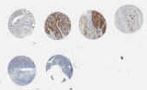 NSCLC (E2, F2, G2, H2)