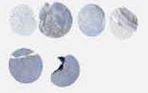 TNBC<br>(E1, F1, G1, H1)