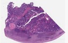 sample A (block 1, slide 1)
