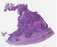 sample A (block 1, slide 144)