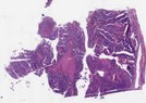 sample A (block 2, slide 145)