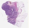 sample B (block 1, slide 160)