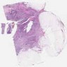 sample E (block 1, slide 65)