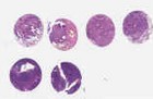 NSCLC (E2, F2, G2, H2)