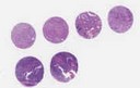 NSCLC (E2, F2, G2, H2)