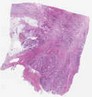 sample A (block 1, slide 149)