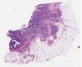 sample B (block 1, slide 1)