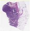 sample B (block 2, slide 121)