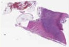 sample D (block 1, slide 1)