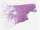 sample A (block 1, slide 1)