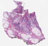 sample B (block 1, slide 1)