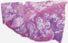 sample B (block 2, slide 139)