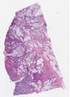 sample B (block 2, slide 185)