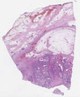 sample D (block 2, slide 122)