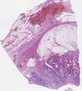 sample D (block 2, slide 175)