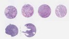 NSCLC (E2, F2, G2, H2)