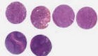 NSCLC (E2, F2, G2, H2)